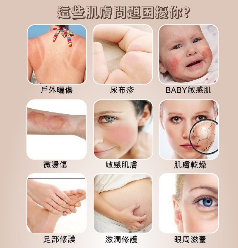 澳思萊紅牌萬用木瓜霜100g