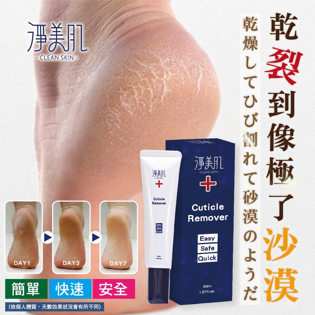 淨美肌 死皮角質軟化液 30ml