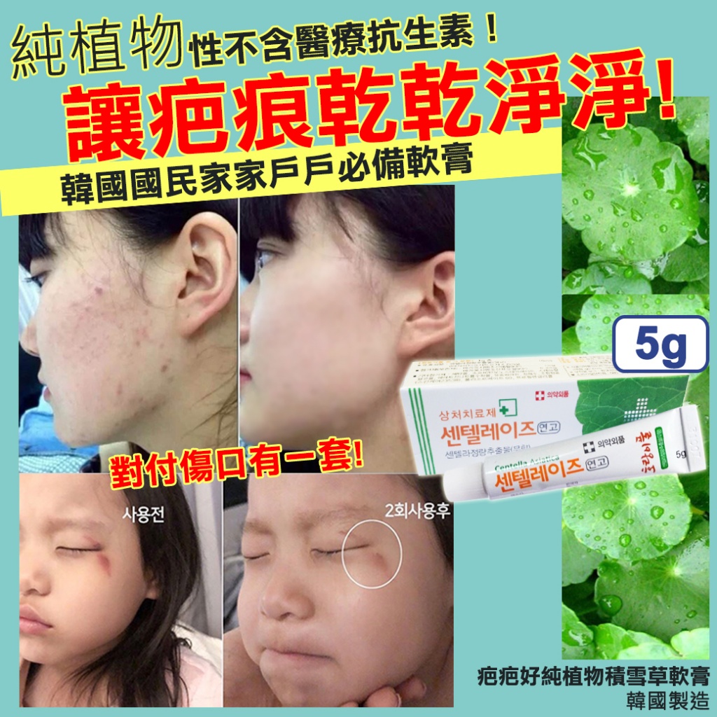 韓國 疤疤好純植物積雪草軟膏 5g