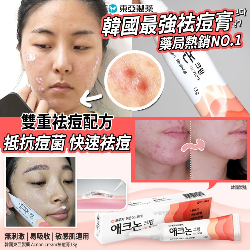 韓國🇰🇷東亞製藥 Acnon cream袪痘膏13g