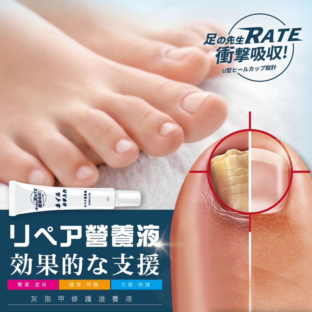 足の先生 台灣GMP廠 灰指甲修護滋養液 30ml(大容量)