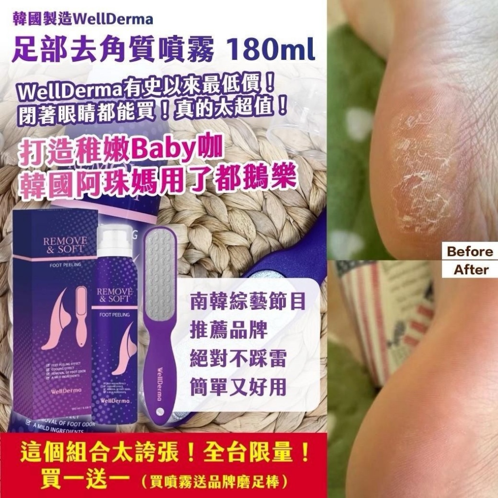 ??韓國WellDerma 足部去角質噴霧 180ml(送品牌獨家磨足棒)