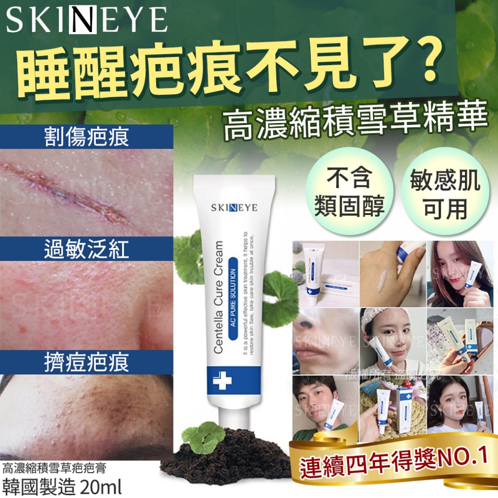 韓國SKINEYE 高濃縮積雪草疤疤膏20ml