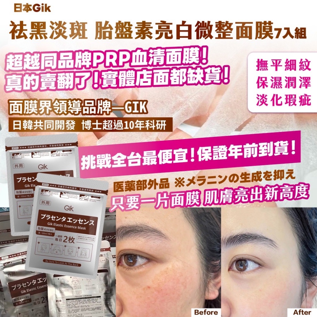 ??日本Gik祛黑淡斑 胎盤素亮白微整面膜(7枚組)