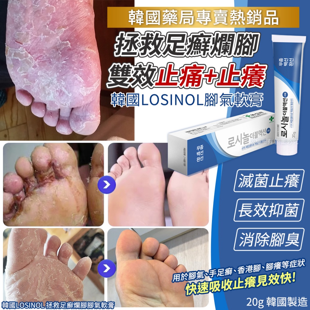 韓國LOSINOL 拯救足癬爛腳腳氣軟膏20g