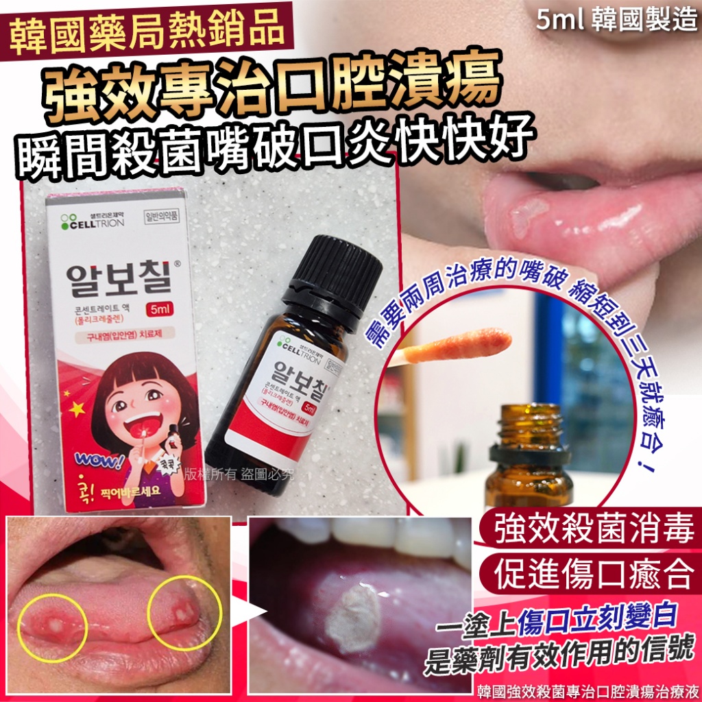 韓國強效殺菌專治口腔潰瘍治療液5ml