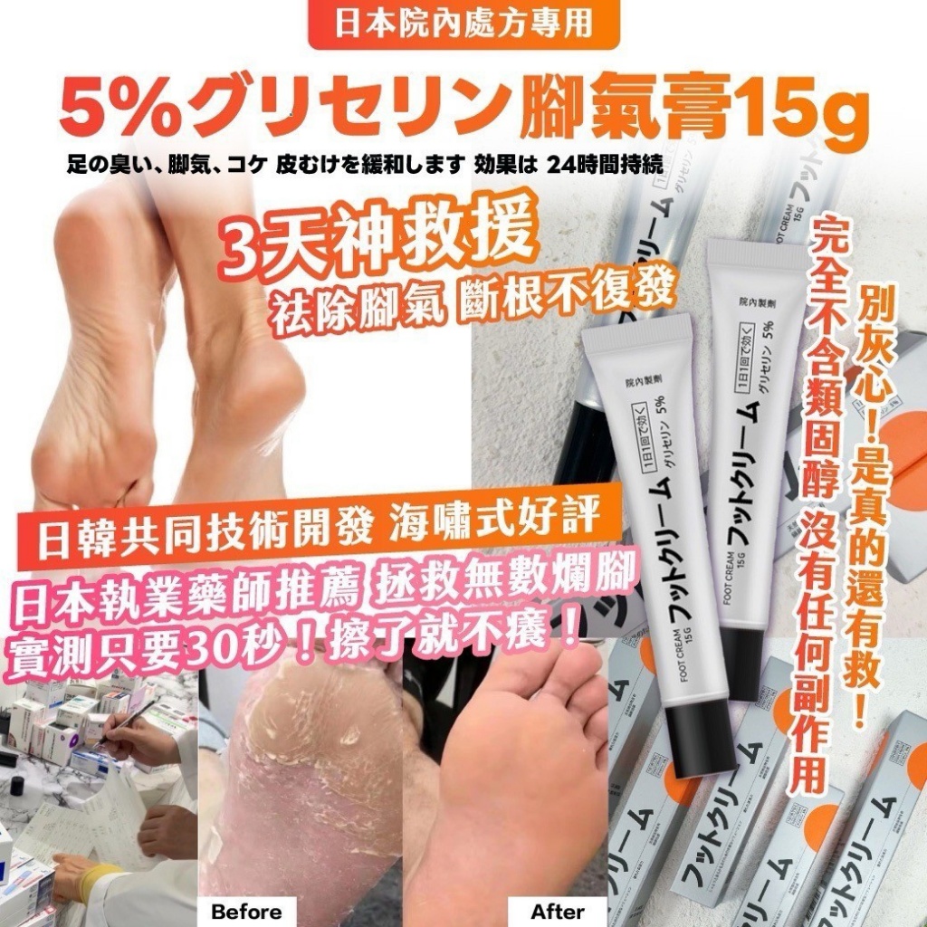 ??日本院內處方專用 ｜5%グリセリン腳氣膏15g
