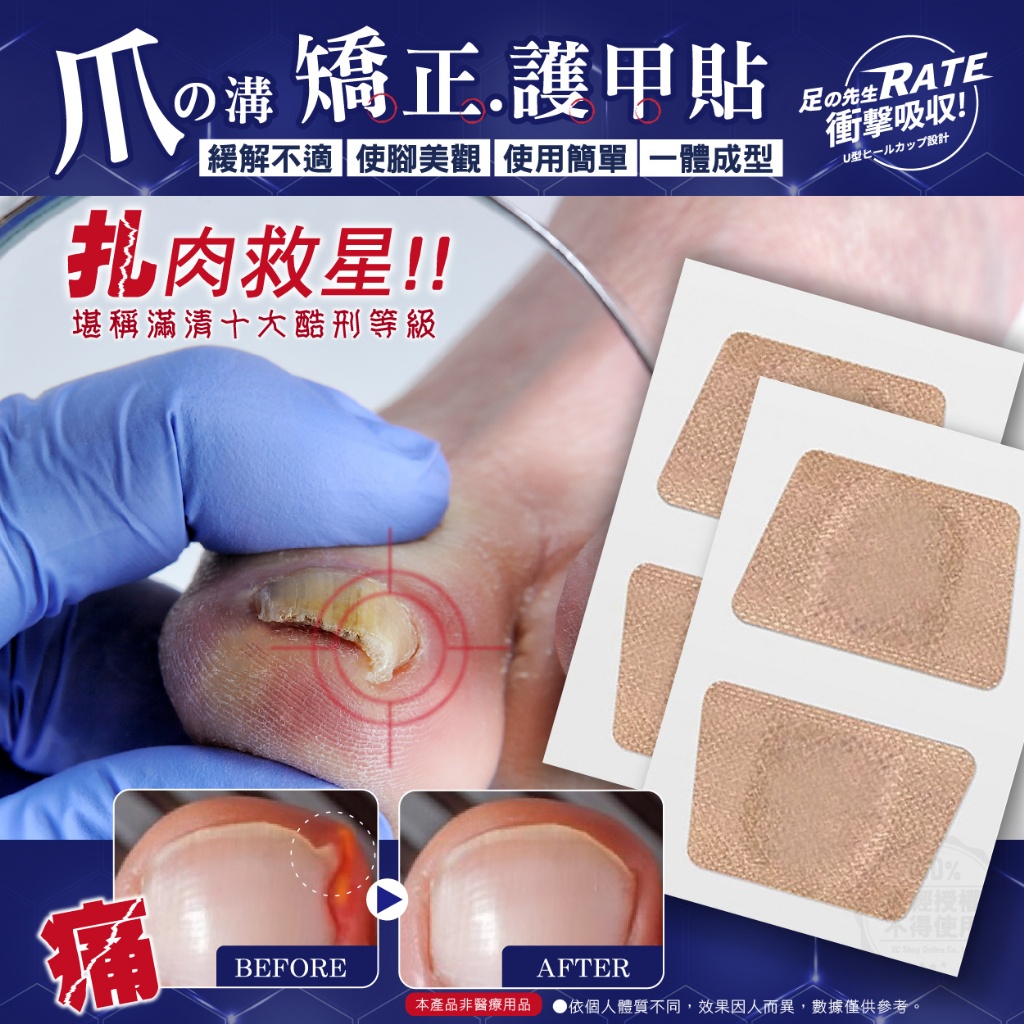 足の先生 甲溝矯正護甲貼(32貼/盒)《一組兩盒》