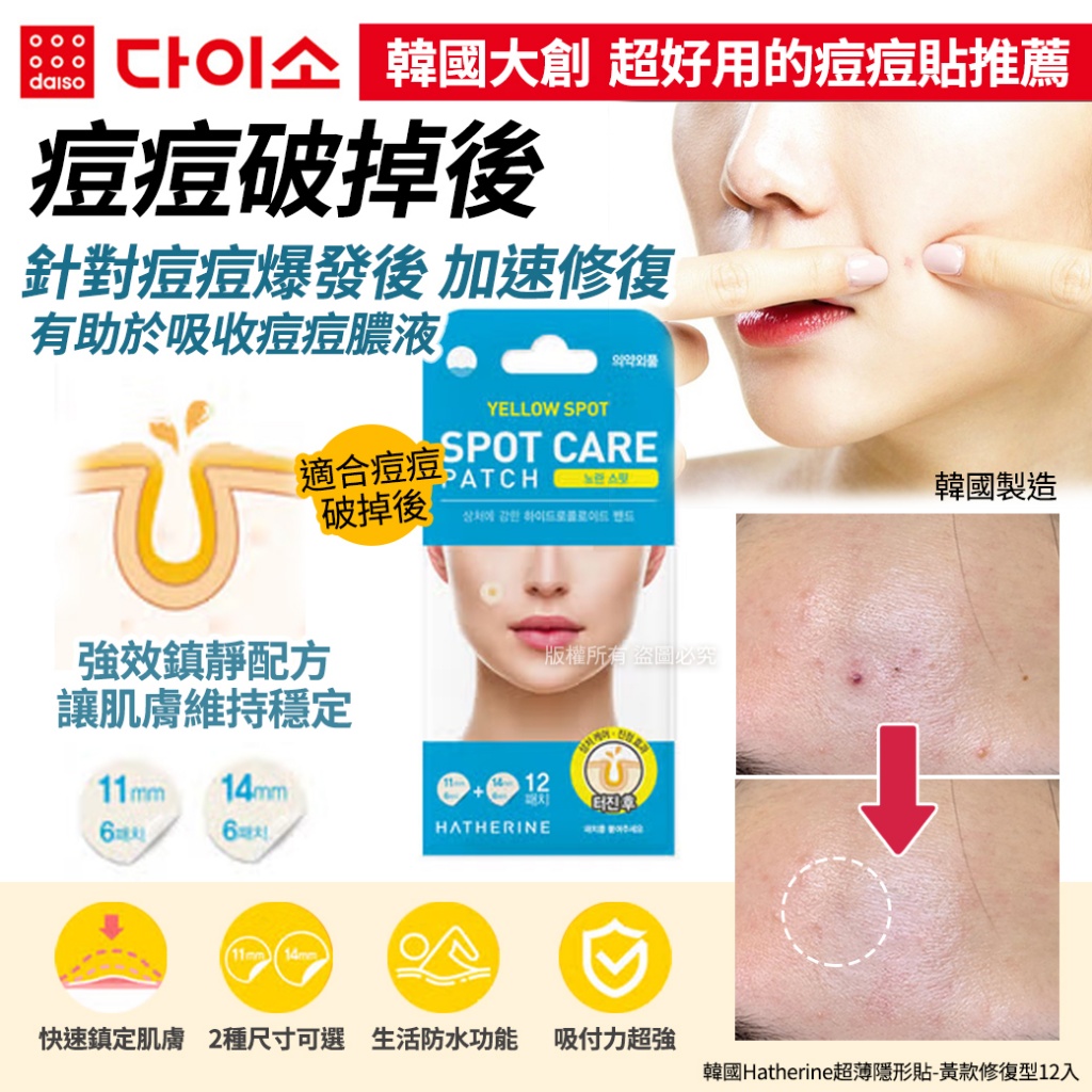 韓國Hatherine超薄隱形貼-黃款修復型12入