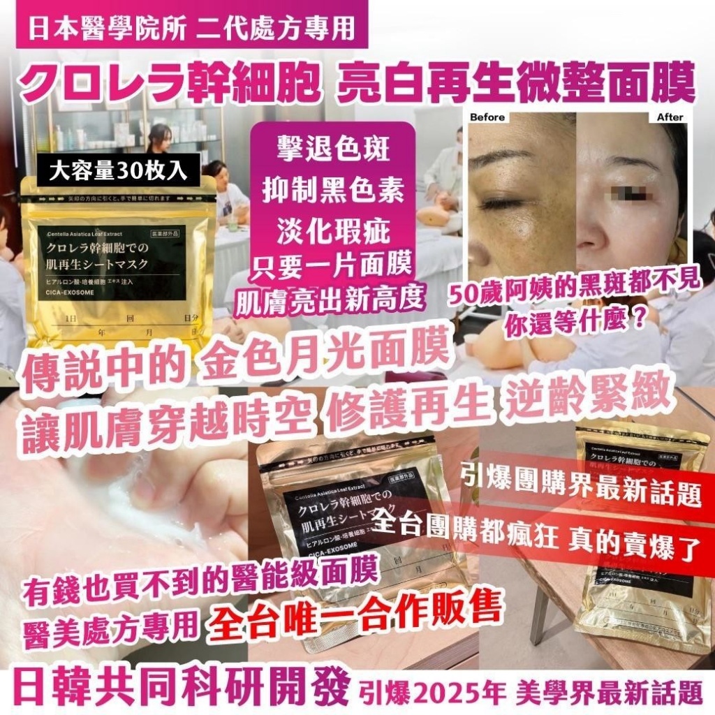 🇯🇵日本醫學院所 二代處方專用 クロレラ幹細胞 亮白再生微整面膜 大容量30枚入(金色)