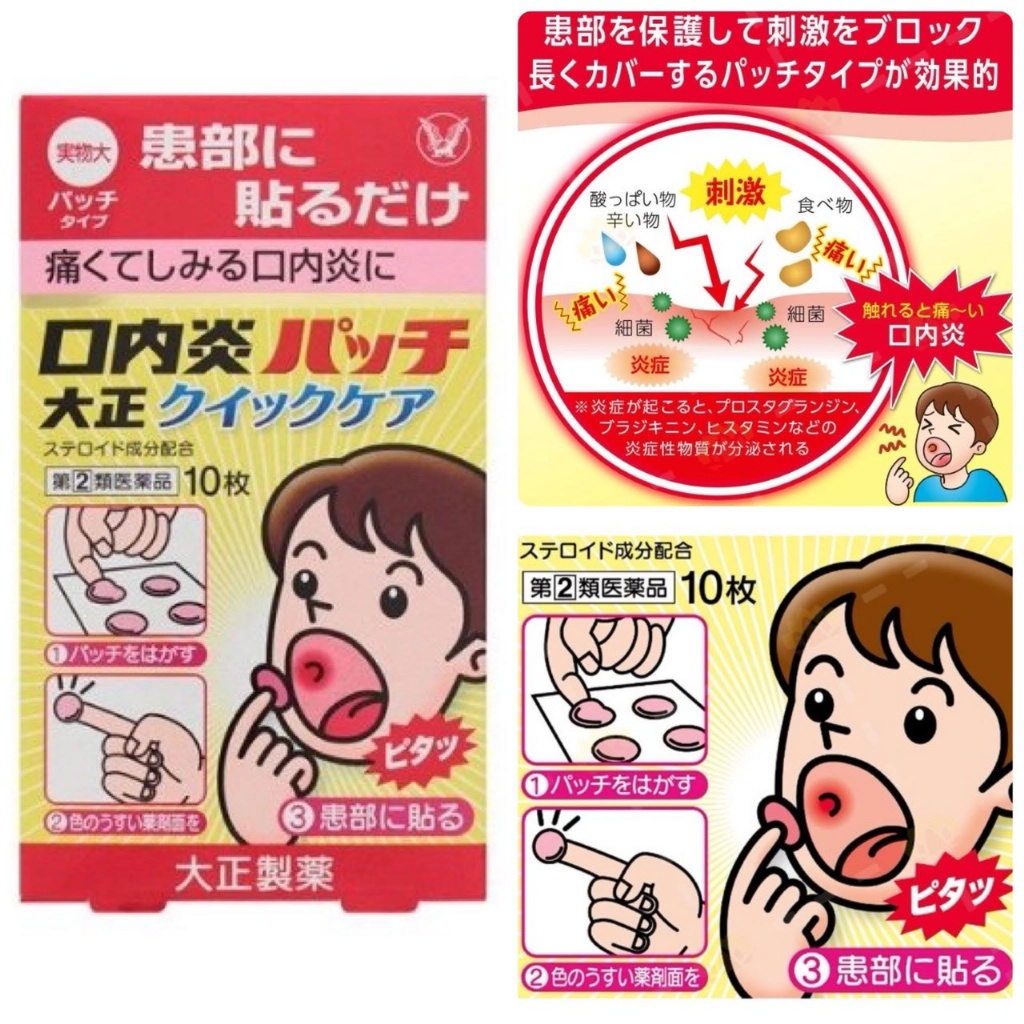 日本🇯🇵大正 黃色速效護理口腔炎貼片 10枚入