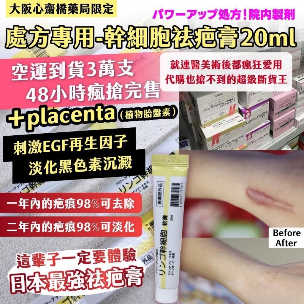 💊大阪心 齋橋藥局限定｜處方專用-幹 細胞祛疤膏20ml